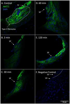 The Acute Effects of Furosemide on Na-K-Cl Cotransporter-1, Fetuin-A and Pigment Epithelium-Derived Factor in the Guinea Pig Cochlea